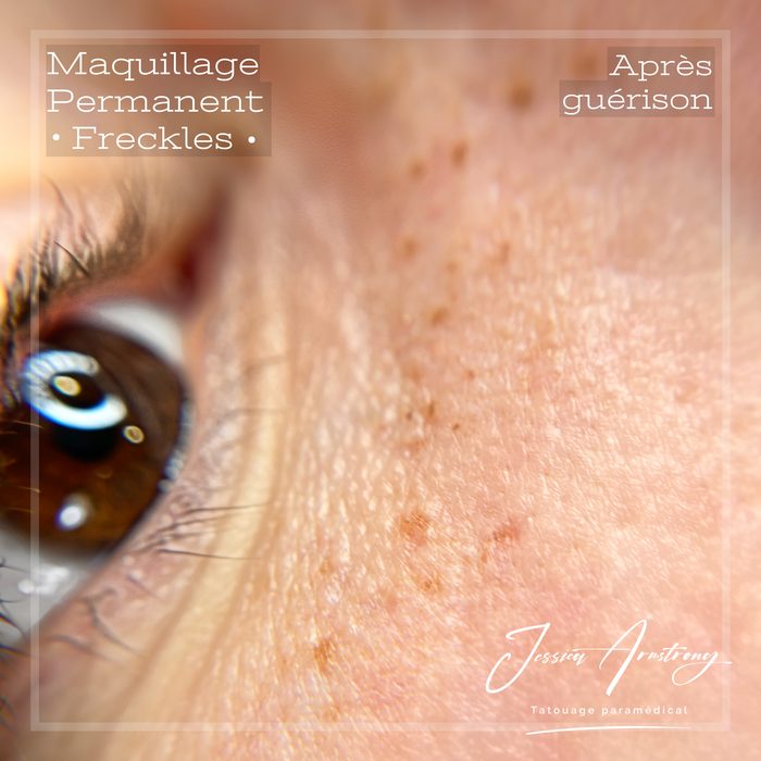 Taches de rousseur en maquillage permanent