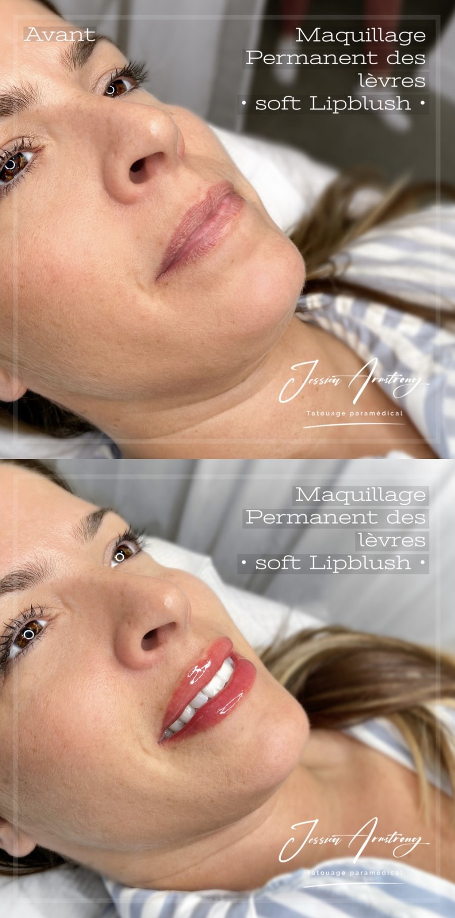 Avant-après maquillage permanent des lèvres, soft lip blush